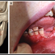 3D scan of the teen’s head (left) and a photograph of the injuries inside the teen’s mouth (right).